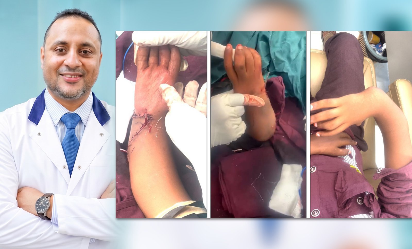 إنجاز طبي غير مسبوق.. جراح يمني في عدن ينهي معاناة طفل من تشوه خلقي معقد بعد 13 عاماً من المعاناة